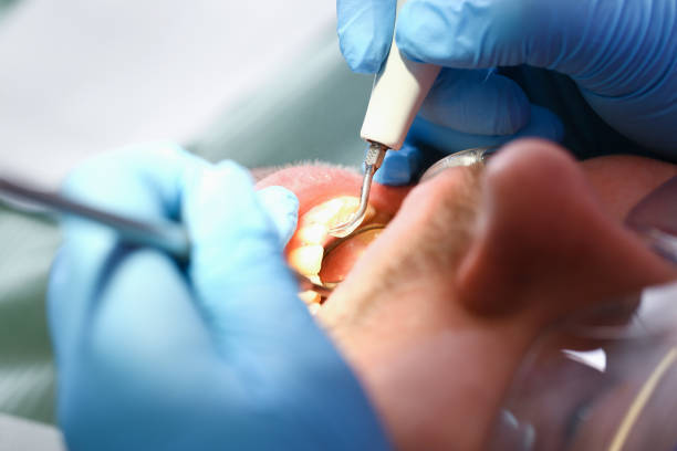Best Emergency Dental Care for Trauma or Injury in Wilton Center, CT