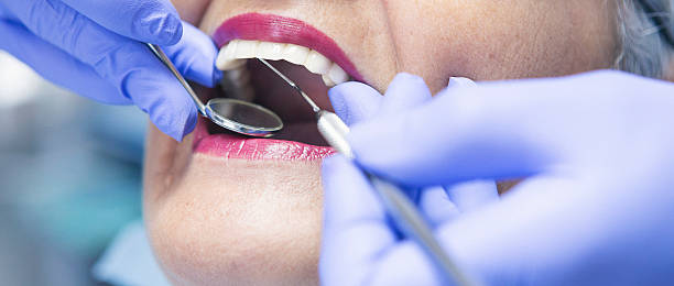Best Emergency Wisdom Teeth Removal in Wilton Center, CT